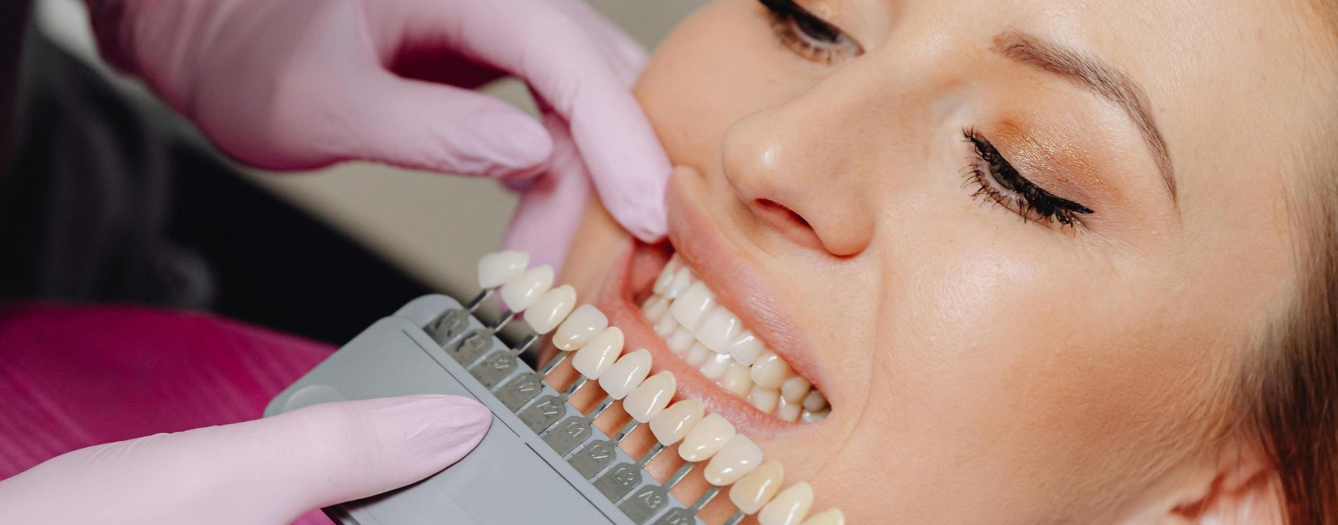 A woman undergoing a dental check-up with a shade guide to match teeth color in a dental clinic.
